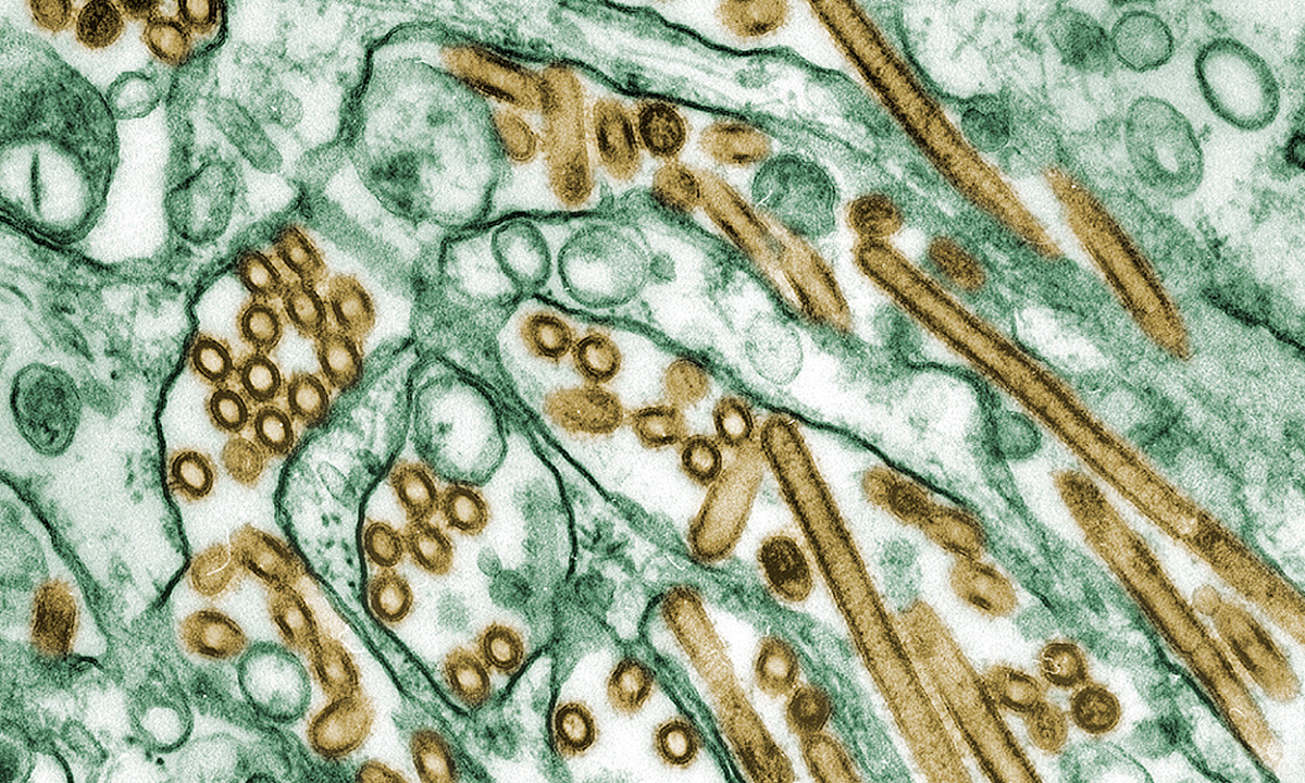 Digitally colorized transmission electron microscopic image of avian influenza A.