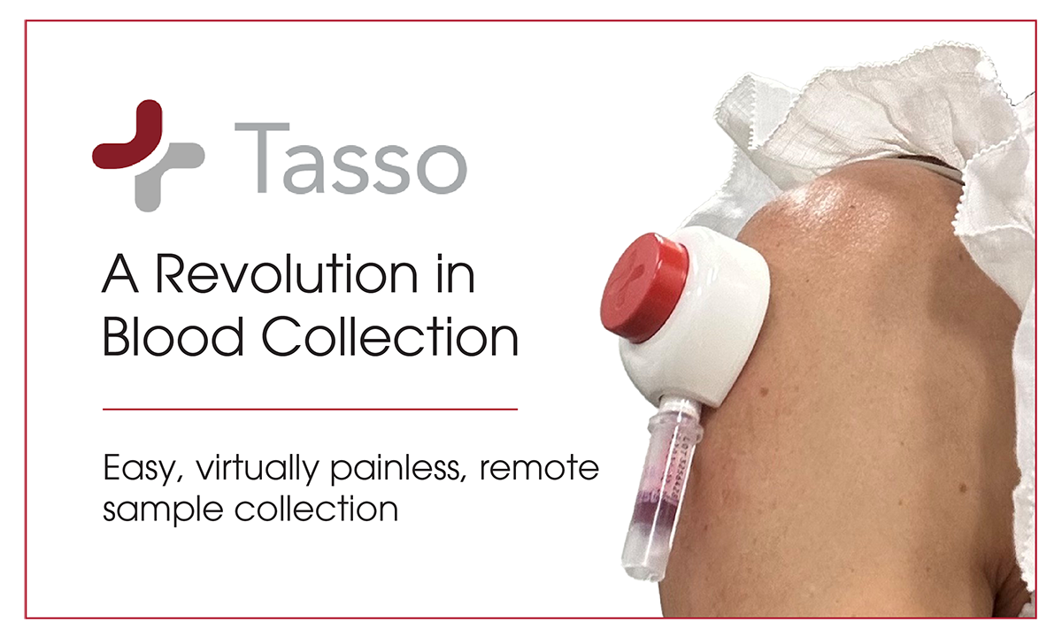 The Tasso+ self-collection device attached to a hand