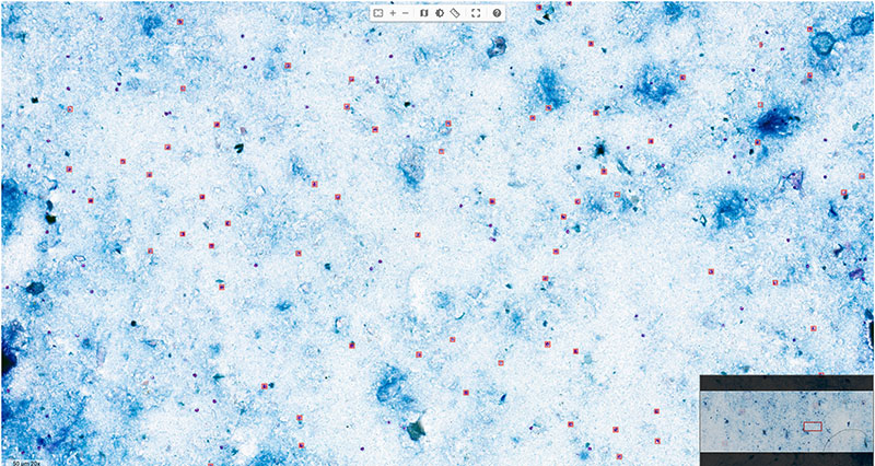 Microscopic acid-fast stain width several highlighted areas
