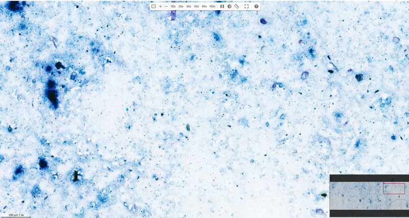 Microscopic acid-fast stain