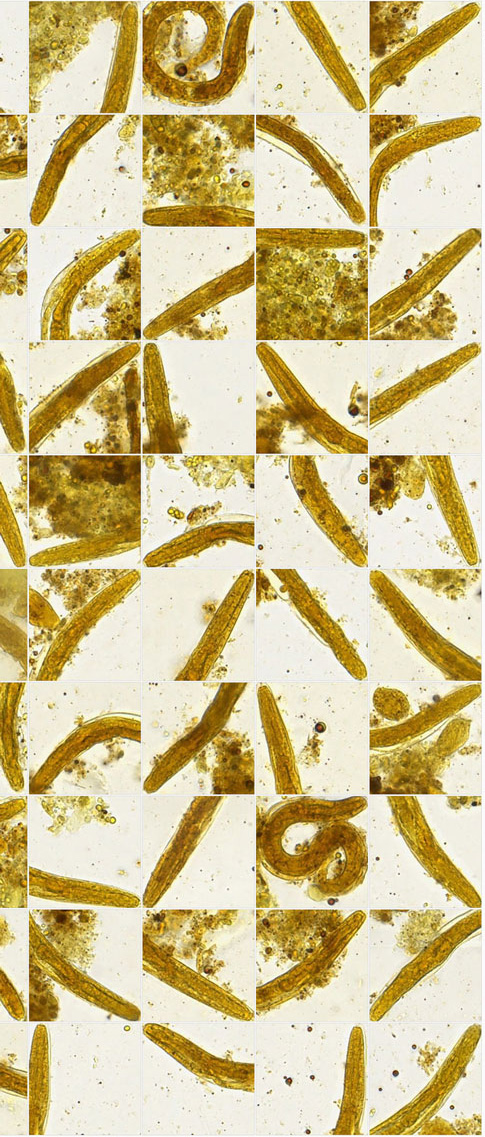 Microscopic image of Larvae of Strongyloides stercoralis