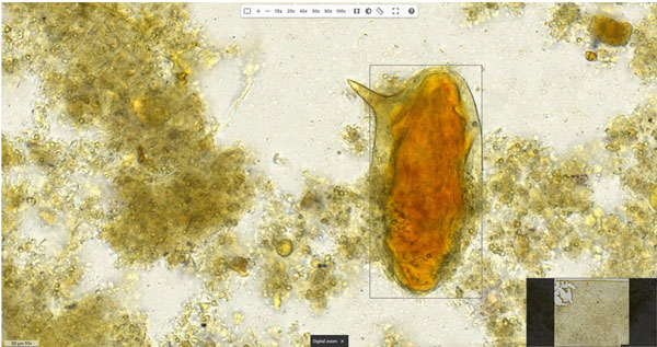 Microscopic image of parasite